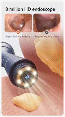 Ear Cleaning Camera - 14 Tools Kit