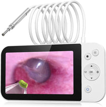 Digital Otoscope with 3.9mm Lens & HD Camera – Ear Wax Removal Tool for Kids & Adults