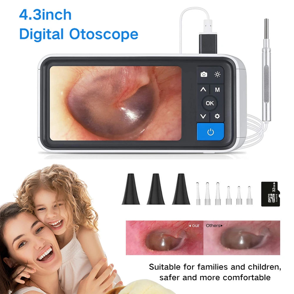 Digital Otoscope with 3.9mm Lens & HD Camera – Ear Wax Removal Tool for Kids & Adults Main image