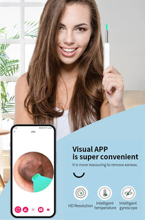 NATFIRE NK3 Pro Smart Visual Ear Cleaner – 1296P HD WiFi Otoscope Ear Wax Removal Kit